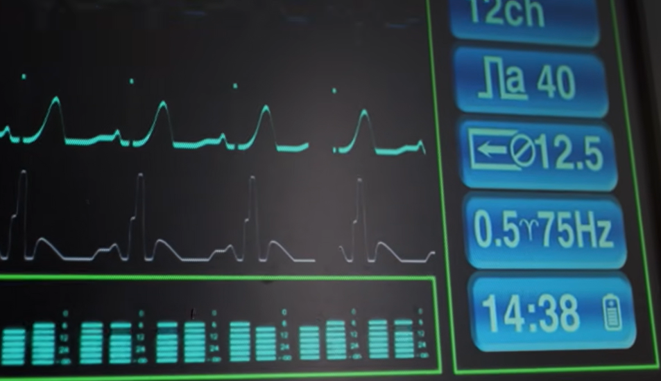anel inteligente mede a variabilidade cardiaca